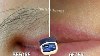 How to use Vaseline to permanently get rid of unwanted hair on the face and body.