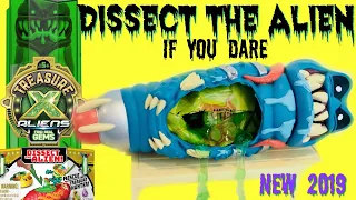 TREASURE X ALIENS Unboxing!  DISSECTING ALIENS with SLIME!!  ULTRA RARE FOUND!! BRAND NEW 2019