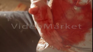 Man with a bleeding wound close-up