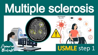 Multiple Sclerosis | Pathology, Immunology , diagnosis and treatment of MS | USMLE step 1