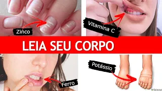 8 SINAIS ALARMANTES DE FALTA DE NUTRIENTES NO SEU CORPO