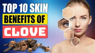 Top 10 Clove Skin Benefits And Homemade Beauty Recipes