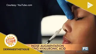 DERMAESTHETIQUE: Nose job using hyaluronic acid