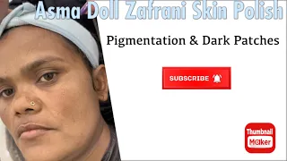 Pigmentation & Dark Patches Treatment