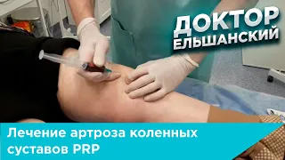 Лечение артроза коленных суставов PRP (плазмой обогащенной тромбоцитами)