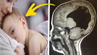 Boy Born Without A Brain, 6 Years Later Look At What Doctors Find Inside | Wabs Stories