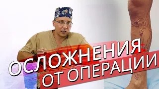 Осложнения операционного лечения вен.