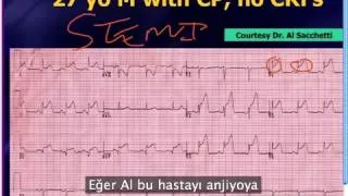 Mattu EKG Vakası: ST Elevasyonunda Ayırıcı Tanı - 3 Haziran 2013 (Türkçe Altyazılı)