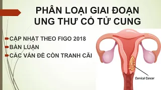 PHÂN LOẠI ĐOẠN UNG THƯ CỔ TỬ CUNG THEO FIGO 2018