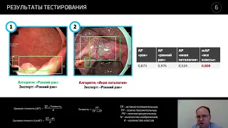 19) Разработка и апробация системы поддержки принятия врачебного решения в эндоскопии