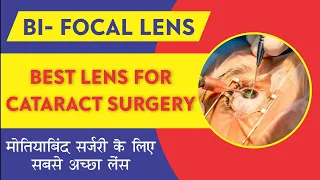 Bifocal lens after Cataract Surgery | Best IOL Lens Choices | बाइफोकल लेंस