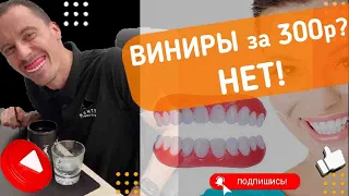 Виниры за 300 р? Как вам результат?