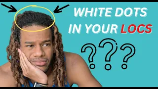 White Dots in Your Locs? Watch this! [4K 2023]