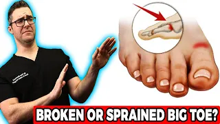 Broken Big Toe or Sprained Big Toe Joint? [BEST Home Treatment 2022]