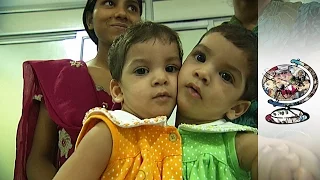 Conjoined Twins In Rural India (2012)