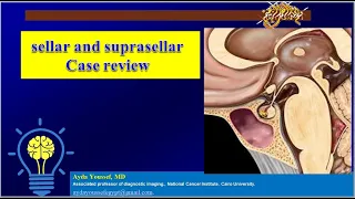 sellar,suprasellar lesions