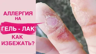 АЛЛЕРГИЯ на гель лак | Вся правда о гипоаллергенных базах