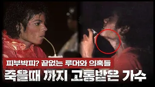 피부박피? 온갖 루머로 둘러싼 마이클 잭슨, 그는 누구인가