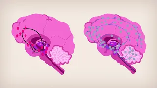 Quels sont les effets de l'amphétamine sur le cerveau ?