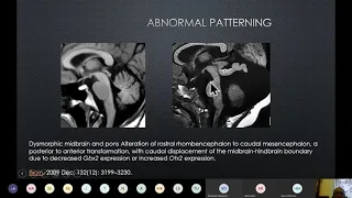 Infratentorial anatomy. Organisation and intrinsic anatomy.