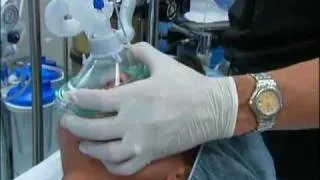 NT About Anesthesia Ch. 5 - General Anesthesia