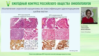 Новая классификация ВОЗ опухолей женской репродуктивной системы