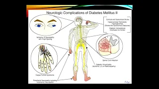 Neurologic Complications of Systemic Disease