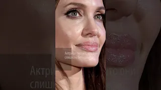 Все в восторге, а она стесняется: Анджелина Джоли заявила, что комплексует из-за своих губ