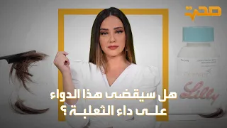 هل سيقضي هذا الدواء على داء الثعلبة؟