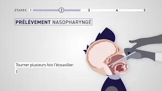 Vidéo de démonstration du test antigénique COVID-VIRO® (AAZ)