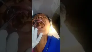 poor oral hygiene: worms inside mouth; a case from Chhattisgarh