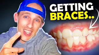 Getting Braces? Questions you SHOULD be asking your ORTHODONTIST AND DENTIST...