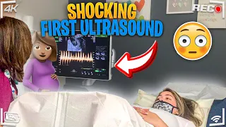 Shocking first ultrasound *WE HEARD THE HEARTBEAT*