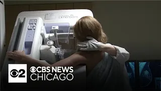 Chicago doctor explains new breast cancer screening guidelines