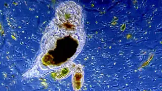 Philodina Rotifer