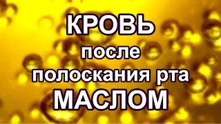 Кровь после полоскания рта маслом