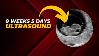 8 Weeks 5 Days Ultrasound: Baby's First Heartbeat and Development!!