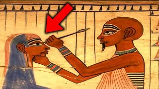 What Surgery Was ACTUALLY Like In Ancient Egypt