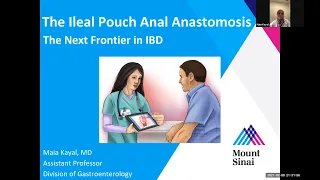 The Ileal Pouch Anal Anastomosis: The Next Frontier in IBD