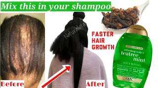 Put this ingredients in your shampoo, it speeds up hair growth 🌱 Natural hair growth secret