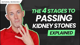 4 Stages to Passing Kidney Stones