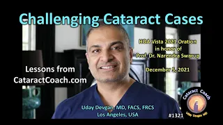 CataractCoach 1321: Challenging Cataract Cases HOA Vista 2021 keynote lecture