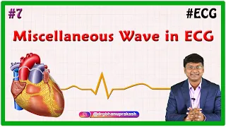 7. Miscellaneous Wave in ECG - ECG assessment and ECG interpretation made easy