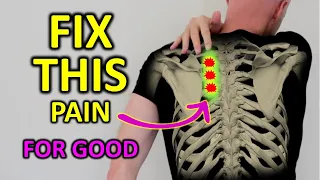 Fix Rhomboid Pain For Good (Shoulder Blade Pain)