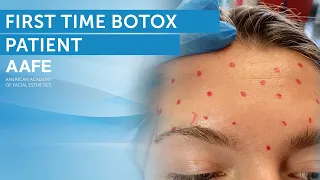 First Time Botox Treatment Plan