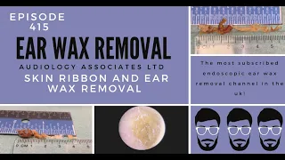 SKIN RIBBON& EAR WAX REMOVAL - EP415