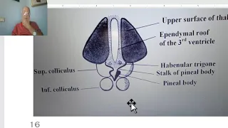 Anatomy of CNS Module in Arabic 2024 (Epithalamus), by Dr. Wahdan.