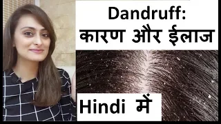 डैंड्रफ के कारण और ईलाज | हिंदी में। dandruff causes & treatment| डॉ  आँचल पन्त