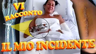 IL MIO INCIDENTE 😷- Quante ossa ho rotto? Ecco i danni.....