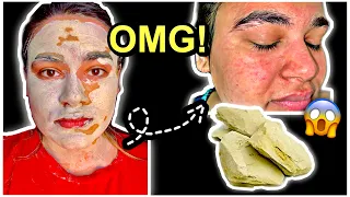 I applied MULTANI MITTI on my face for 3 days & this is what happened...